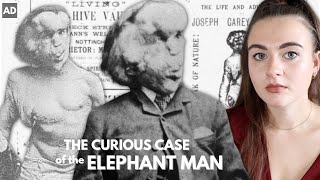 The MYSTERY Behind the Elephant Man