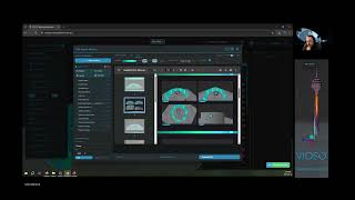 Famous VIOSO Experience Designer - Exporting PDFs and Sharing Links Net Worth