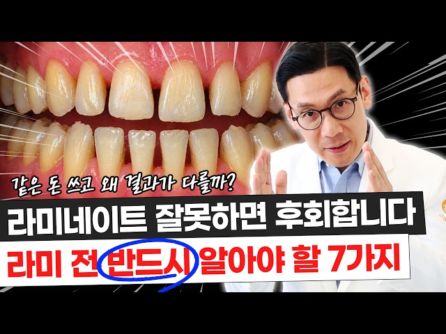 라미네이트 하기 전에 꼭 보세요… 후회하는 사람 특징 7가지 #라미네이트