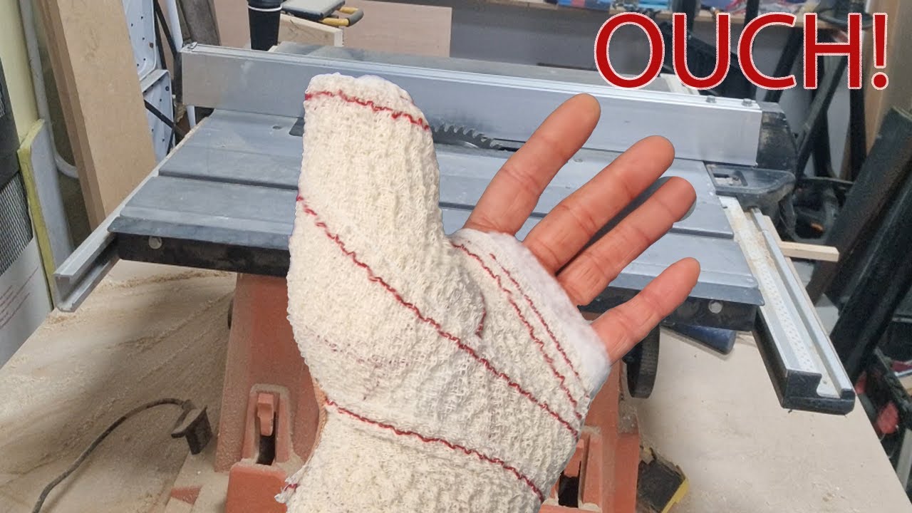 I Survived a Table Saw Accident