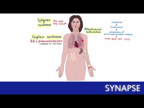 Video: Neuron Nosiseptif Mendeteksi Sitokin Pada Artritis