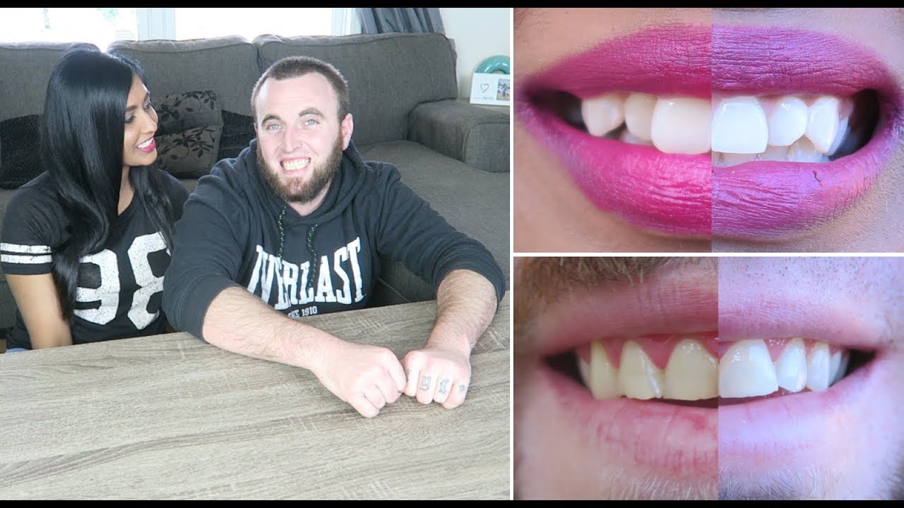 HOW WE WHITEN OUR TEETH AT HOME AFFORDABLE TEETH WHITENING FOR