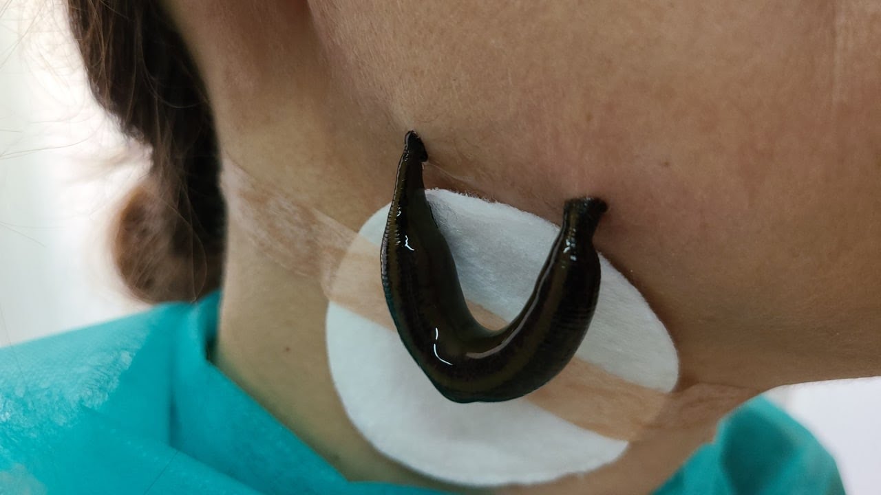 Как лечить фронтит острый и хронический? - YouTube