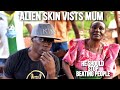 Alien skin Vists His Mom In Kiboga  (she told him, stop beating People)