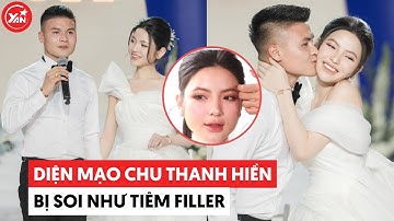 Đám cưới Chu Thanh Huyền và Quang Hải, diện mạo cô dâu bị soi như tiêm filler