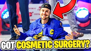 Is Justin Bieber Hiding Cosmetic Surgery Truth?