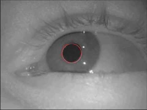 Pupil detection by Hooman Se 1.avi