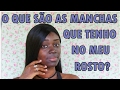 #VEDA15: O QUE SÃO ESSAS MANCHAS ESCURAS NO MEU ROSTO?  FRANCINE MONTEIRO