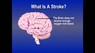 The Stroke Patient   A Comprehensive Guide