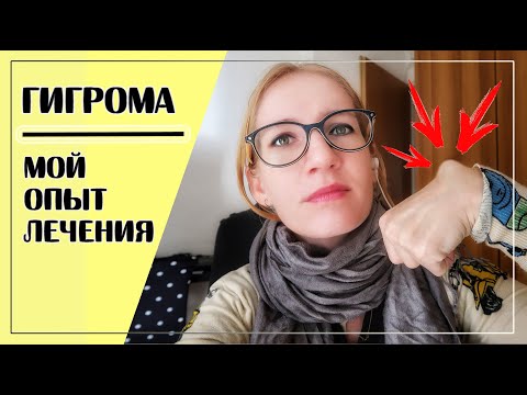 ГИГРОМА - МОЙ ОПЫТ ИЗБАВЛЕНИЯ