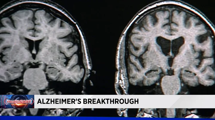 Doctors one step closer to finding cure for Alzheimer's disease