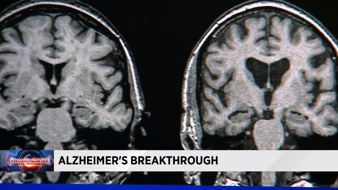 Doctors one step closer to finding cure for Alzheimer's disease