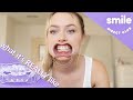 My First 36 Hours With Clear Aligners | Unboxing SDC