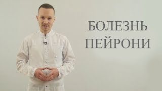 Болезнь Пейрони