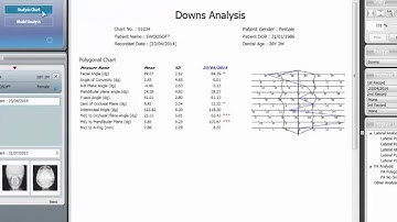 07  Simple Tracing Tutorial Video For OrthoVision