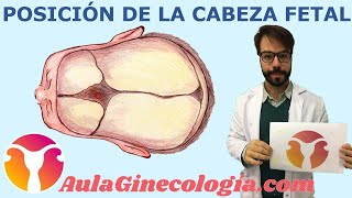 POSICIÓN de la CABEZA FETAL durante el PARTO   - Ginecología y Obstetricia -