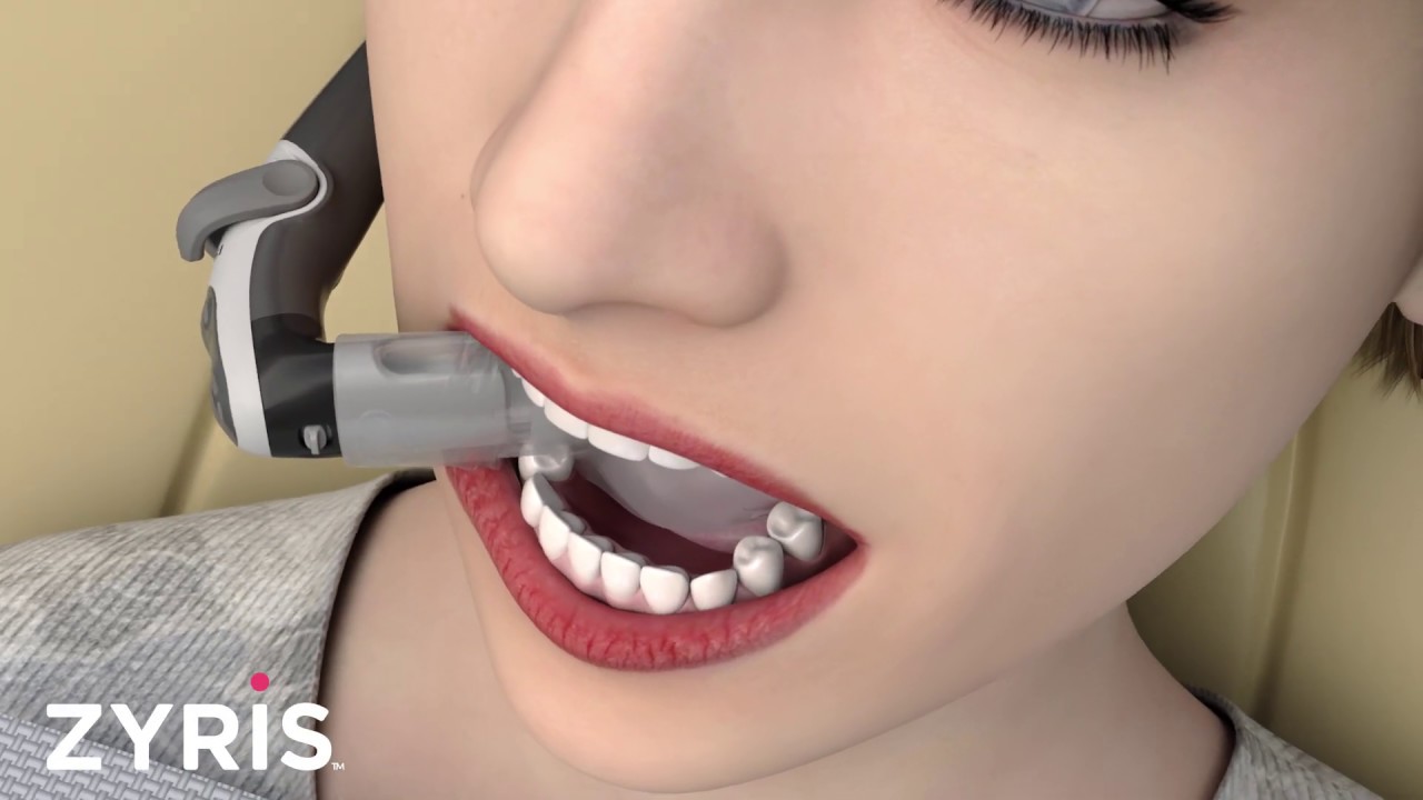 Isolite Mouthpiece Placement Animation YouTube