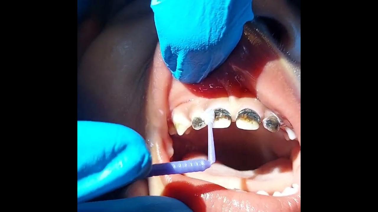 sdf application ecc - YouTube