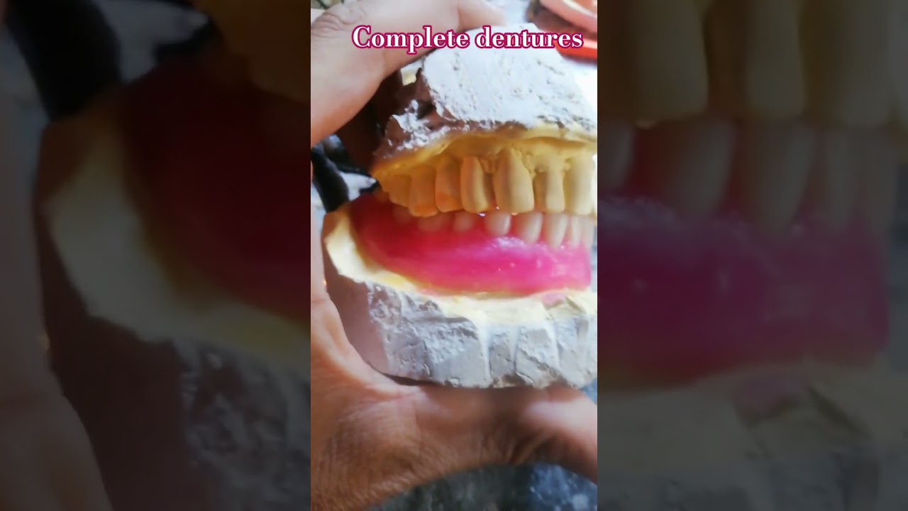 complete dentures lab work 