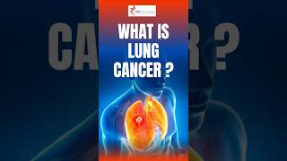 Lung cancer isn’t just a smoker’s disease.