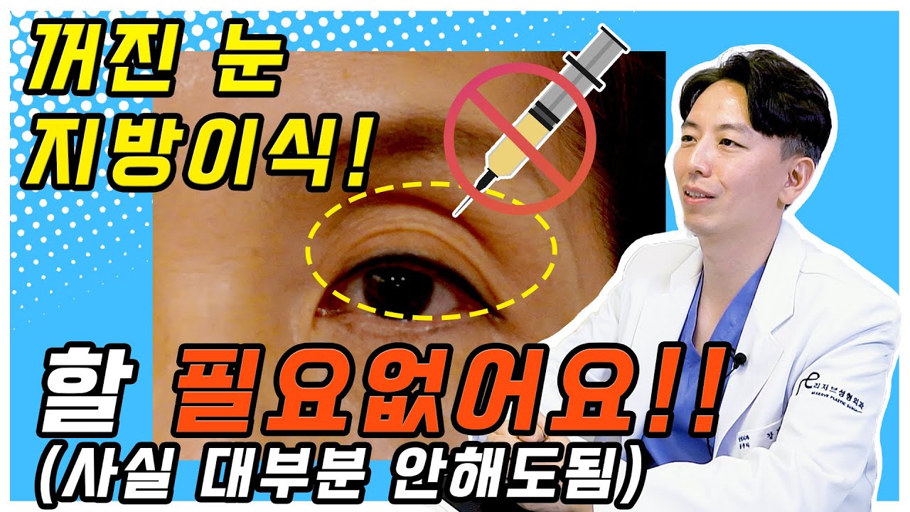 꺼진눈에 지방이식 수술 사실 할 필요없어요(눈성형/부산성형외과)