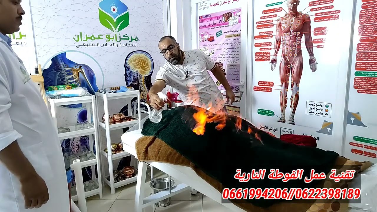 حصة تدريبية حول كيفية العلاج بالفوطة النارية 