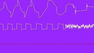 COMMODORE C64 SID - 2018 - WHATS´S GOING ON ? - FIGGE WASBERGER (FEGOLHUZZ)/ Oscilloscope View