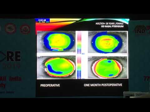 AIOC2019-Hyde Park-I-P1757-Changes in