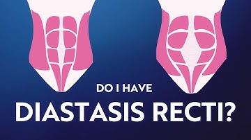 How to test yourself for Diastasis Recti | MUTU System Taster Series