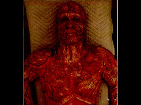 SCP Readings SCP-1121 "The Skinning Disease"