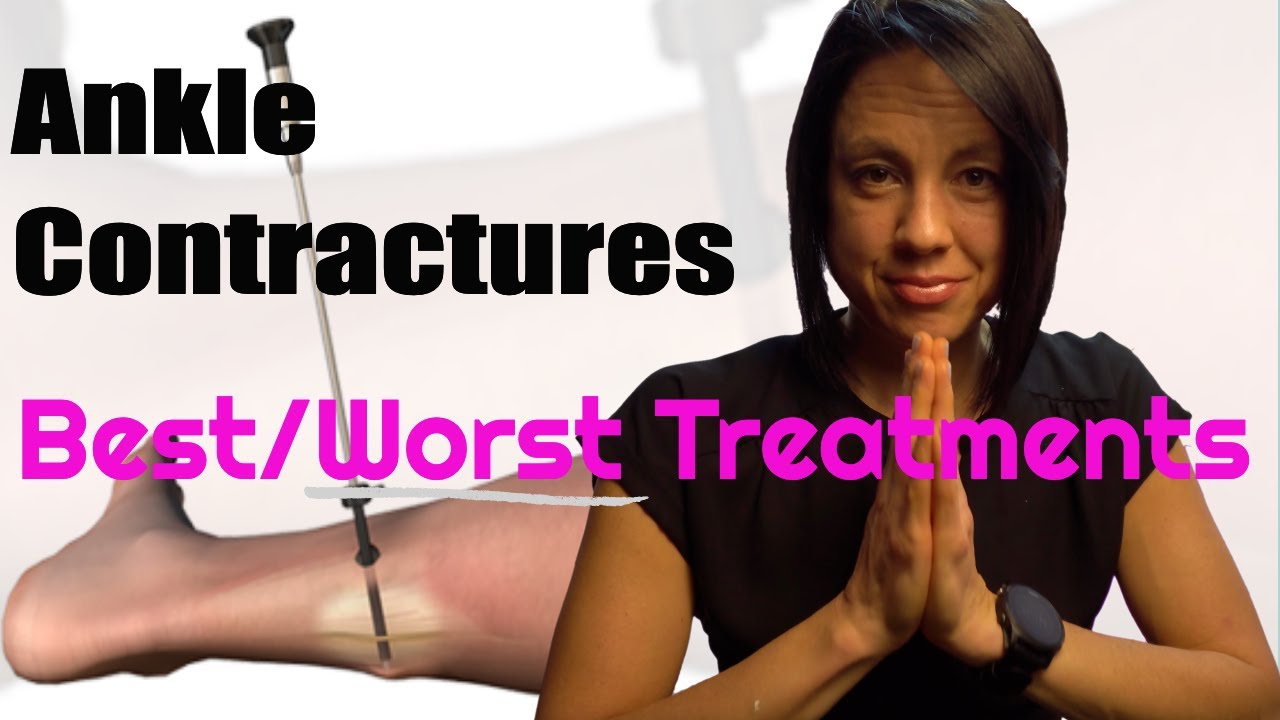 Контрактуры голеностопного сустава: «Что делать» и «Что нельзя»
