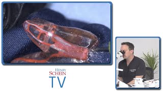 ScheinTV Ep17 Endodontic Innovations
