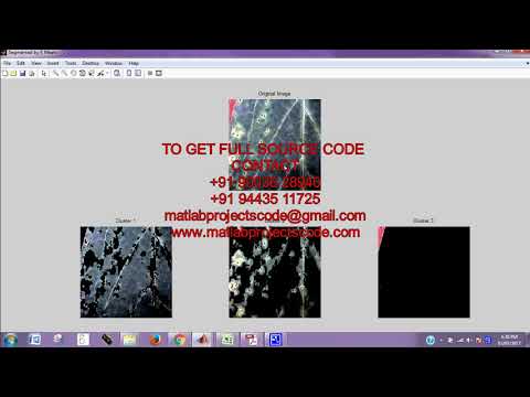 Matlab code for Detection of leaf disease using image segmentation