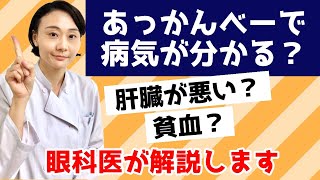 あっかんべーでわかる目の病気？肝臓？貧血？眼科医が解説します。