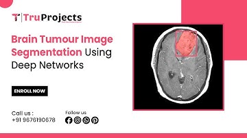 Brain Tumour Image Segmentation Using Deep Networks  final year Engineering projects providers