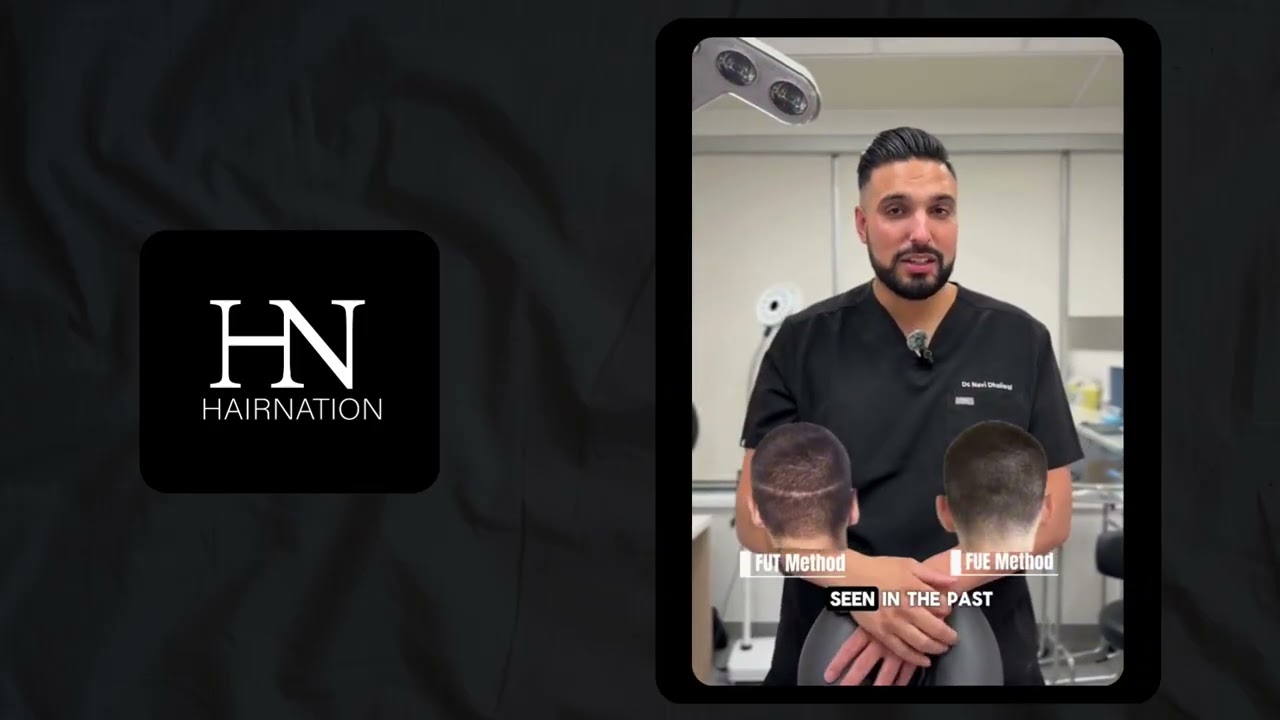 FUT: Follicular Unit Transplantation