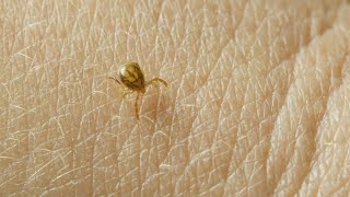 Tips and tricks to fight pesky ticks this summer