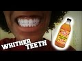 DIY Teeth Whitener | Apple Cider Vinegar