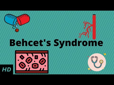 Behcetův syndrom, příčiny, příznaky a symptomy, diagnostika a léčba.