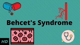 Behcet's Syndrome, Causes, Signs and Symptoms, Diagnosis and Treatment.