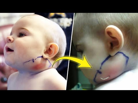 Video: Waarom Steekt Een Baby Zijn Tong Uit?