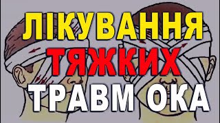 ТРАВМИ ОКА. Багатоетапний підхід в реконструктивному лікуванні тяжких травм ока/Риков vlog. Україна