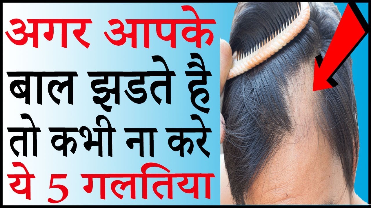 बालो को झड़ने से रोकने के 5 जबरदस्त नुस्खे Hair fall solution for men