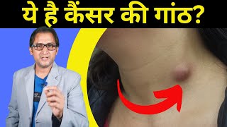 कैंसर की गांठ और नॉर्मल गांठ को कैसे पहचाने | cancer ke lakshan in hindi | Resimi