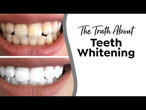 The Truth About Teeth Whitening | Dr. Brigitte White #smiletipsforlife #teethwhitening #peroxide
