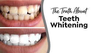 The Truth About Teeth Whitening | Dr. Brigitte White #smiletipsforlife #teethwhitening #peroxide by Dr. Brigitte White 2,079 views 4 years ago 1 minute, 42 seconds