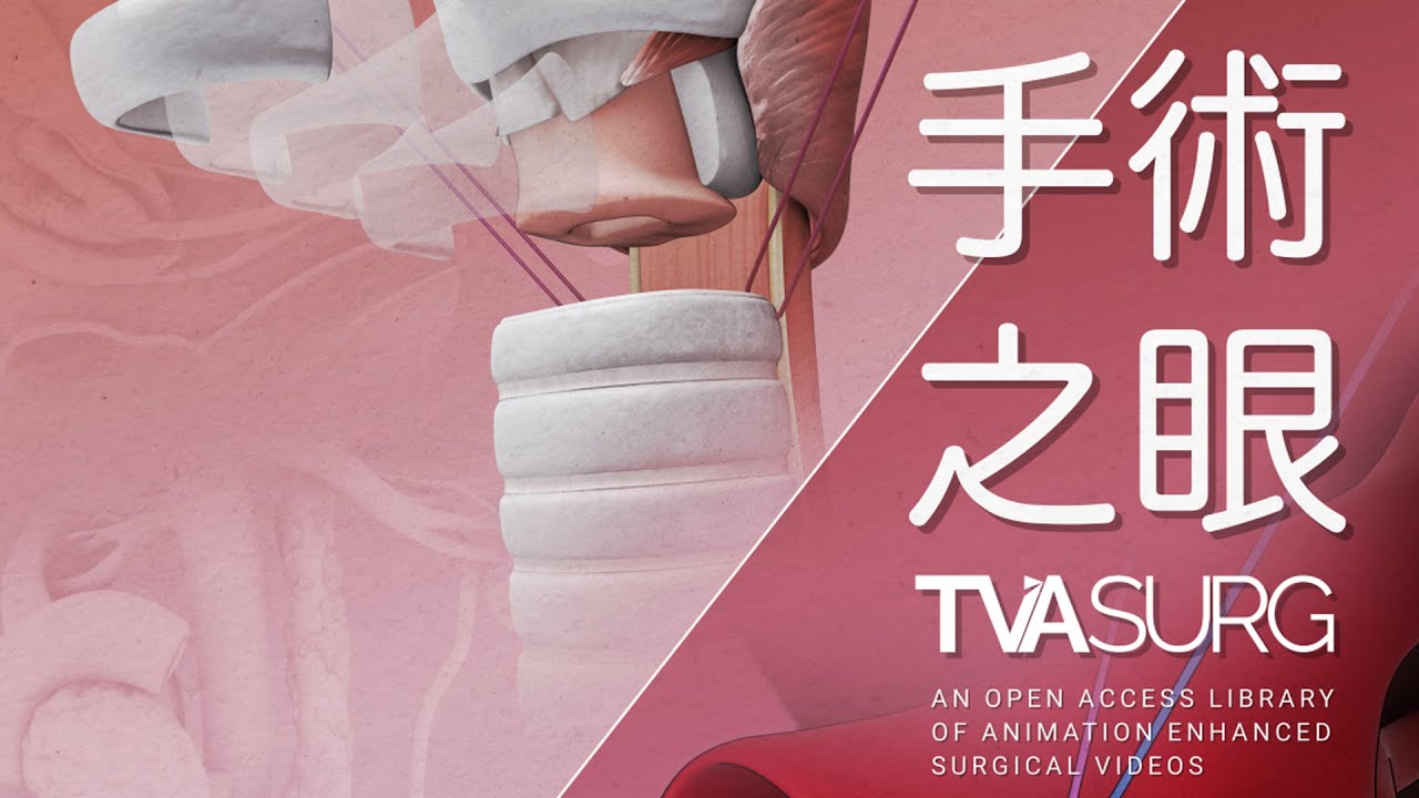 The Surgical Eye | TVASurg x NTUH Exhibition - YouTube