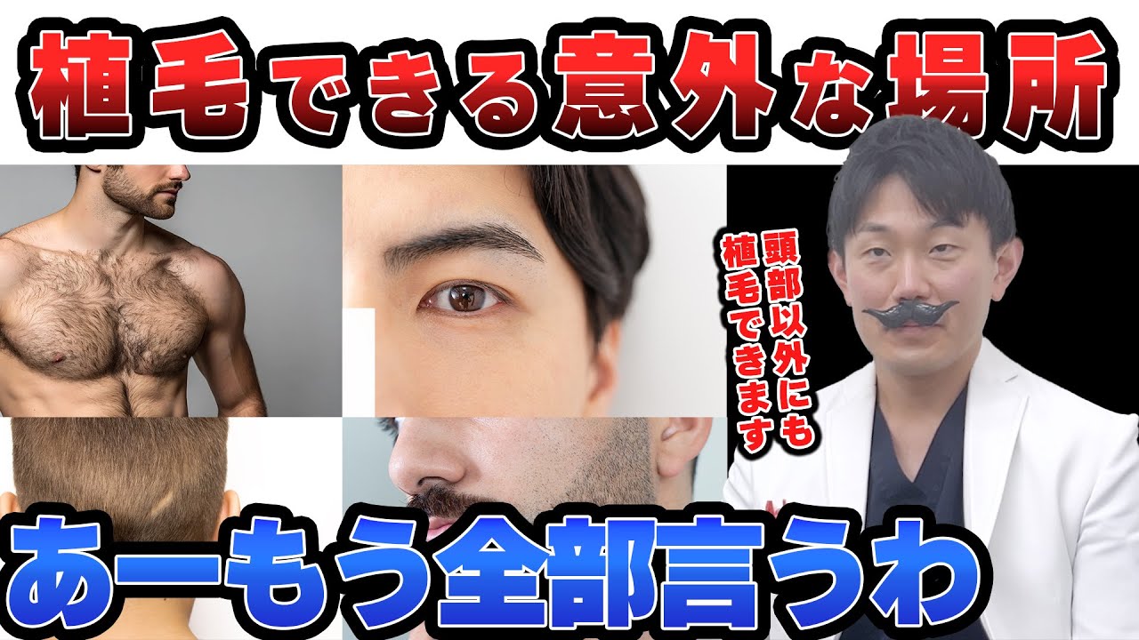 実はこんな場所にも！？当院でできる植毛部位を全部紹介します。