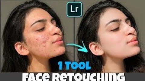 Face Retouching | Pimple Remove In Lightroom | In 2 Minutes | With Just One Tool |@Mkediting302