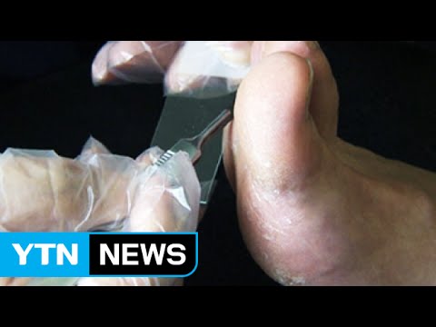 Health Tips for the Rainy Season / YTN